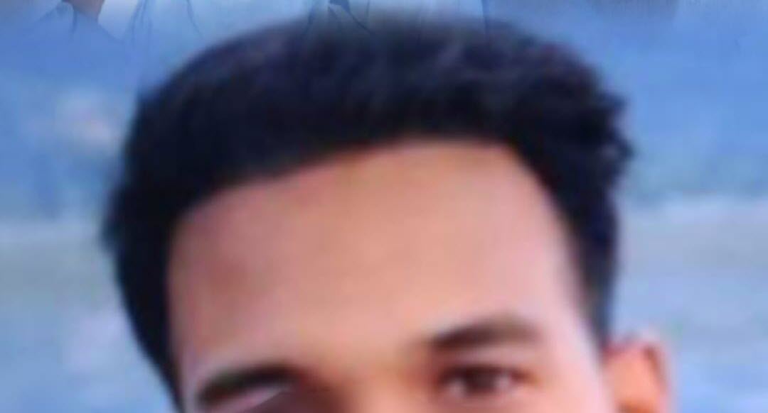 After PRP - Patient 4